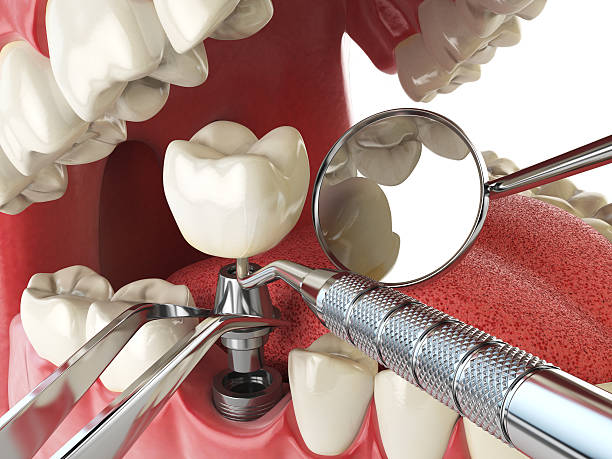 Best Orthodontic Emergency Dentist in Cascades, VA