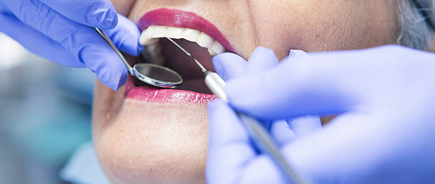 Best Broken or Cracked Tooth Emergency Dentist in Cascades, VA